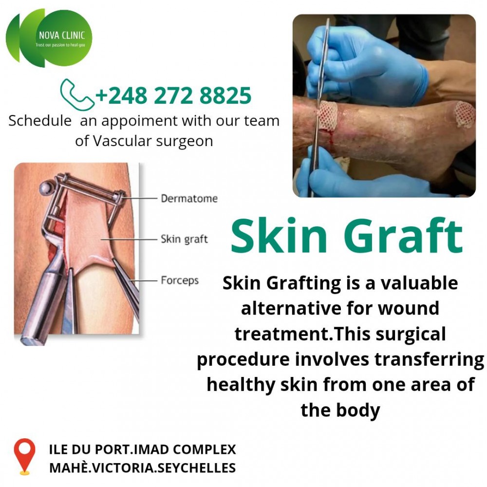 SKIN GRAFT > This surgical procedure involves transferring healthy skin ...